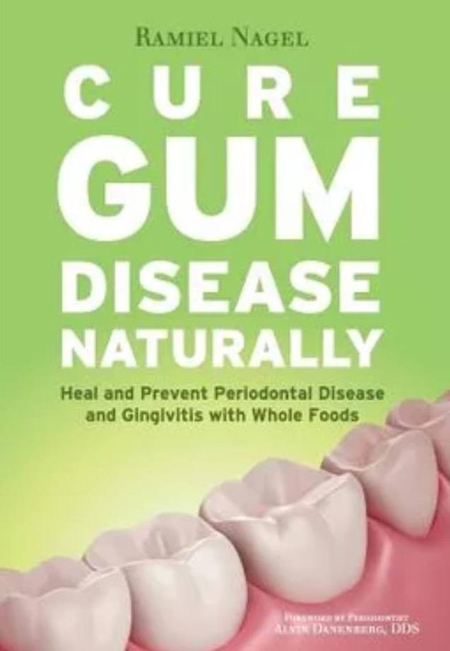 Heal Gingivitis and Periodontal Disease with Whole Foods