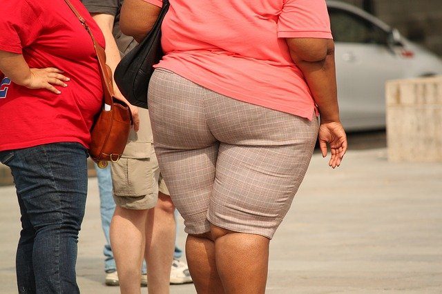 Obese lady